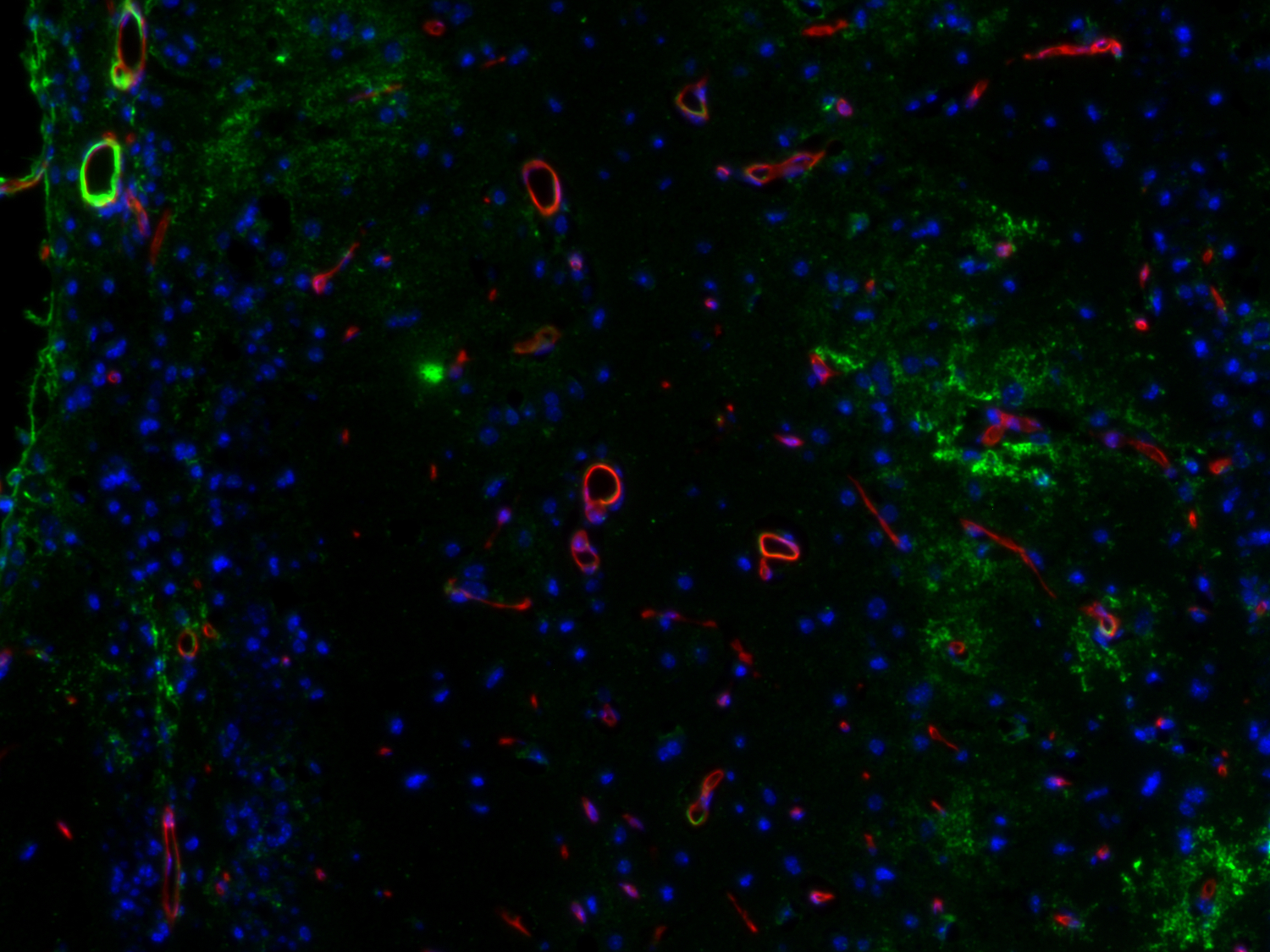 VCAM 1 expression is increased in blood vessels near the stroke lesion site. 
