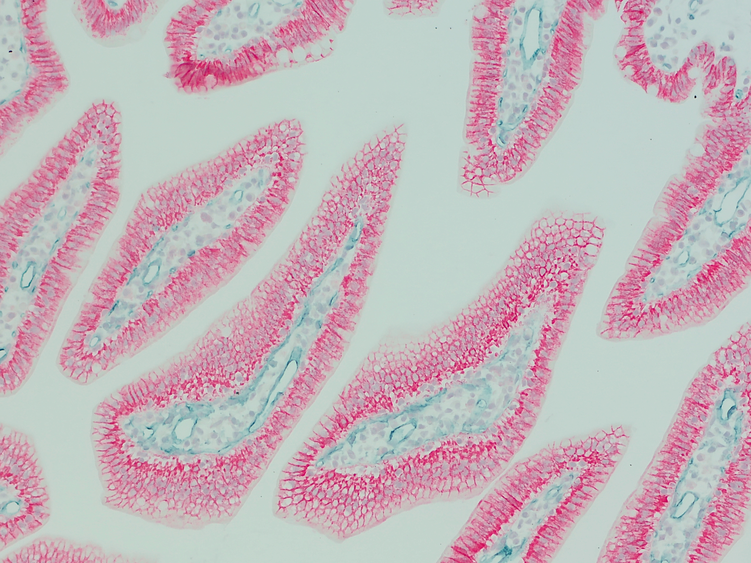 CD31 visualizes blood vessels in mouse small intestine 