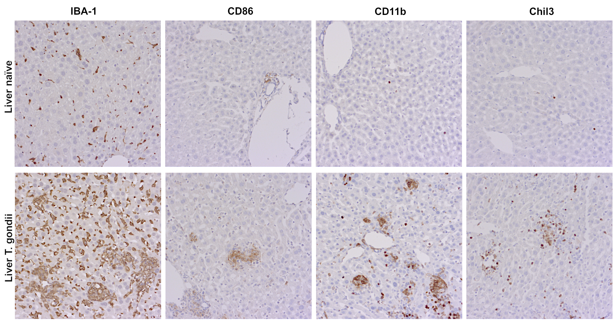 Immunohistochemical detection of IBA-1