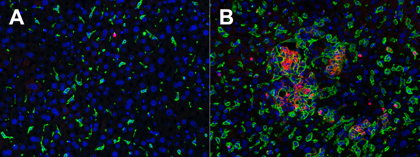 T gondii infected mouse liver with rabbit anti-F4/80