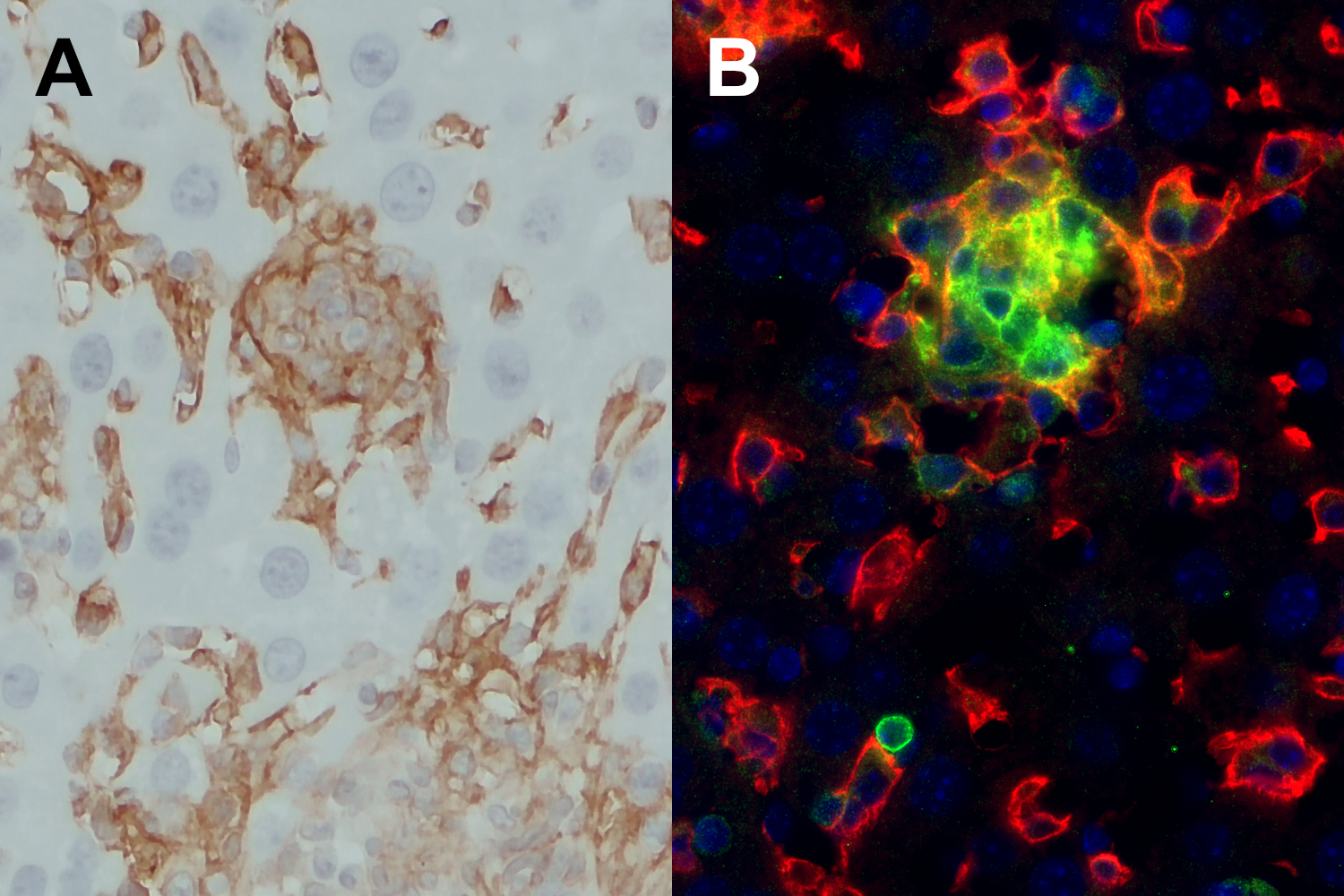 T. gondii infected mouse liver section revealing F4/80 low cells in cell aggregates