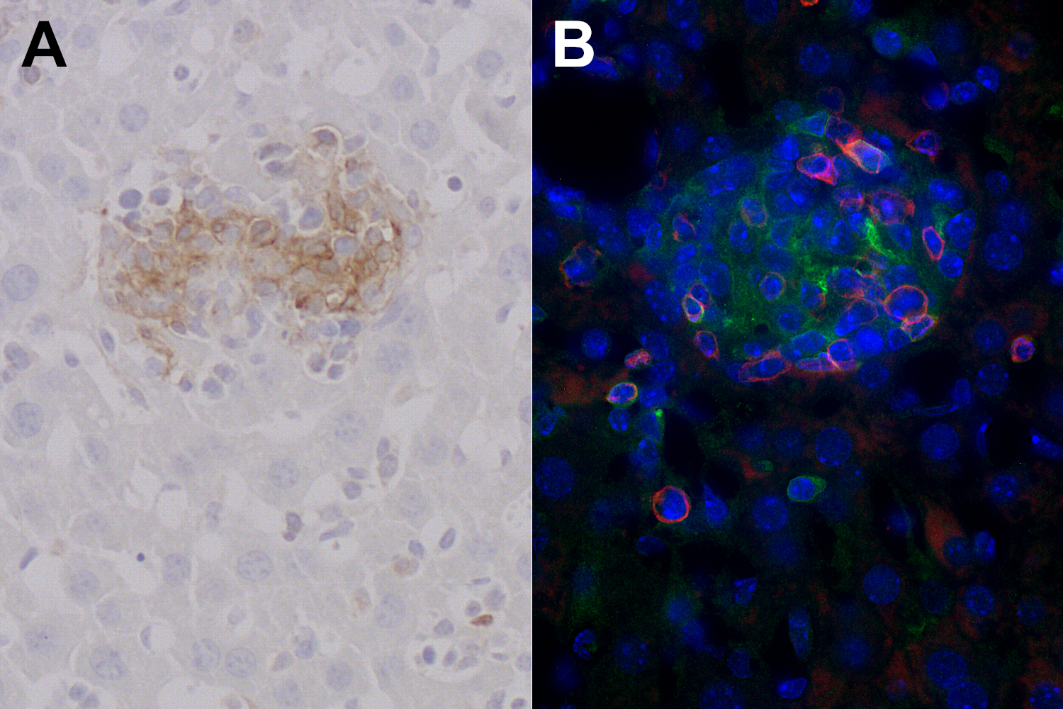 Immunohistochemical detection of CD86