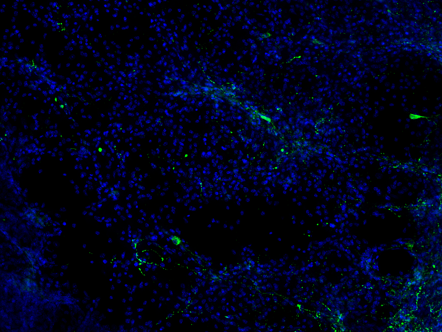 NPY is a neuropeptide with proinflammatory properties that is produced abundantly in the central and peripheral nervous system.
