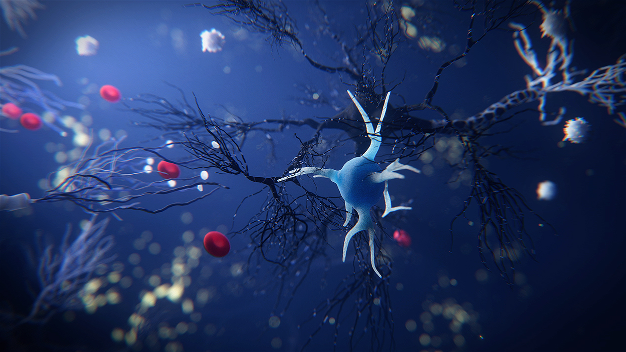 3D rendered image of acute inflammation in the central nervous system (CNS) is accompanied by neurodegeneration and activation of glial cells