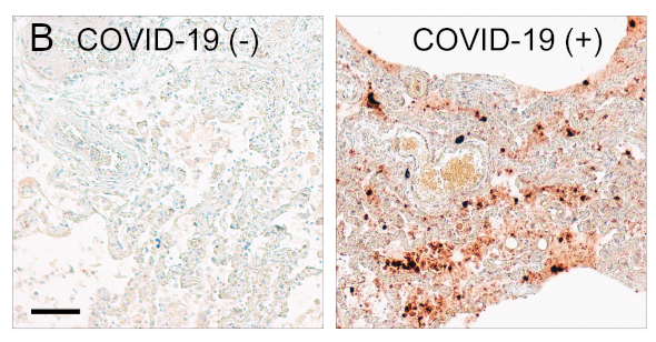 Mouse anti-SARS-CoV-1 and -2 nucleocapsid (clone 53E2)
