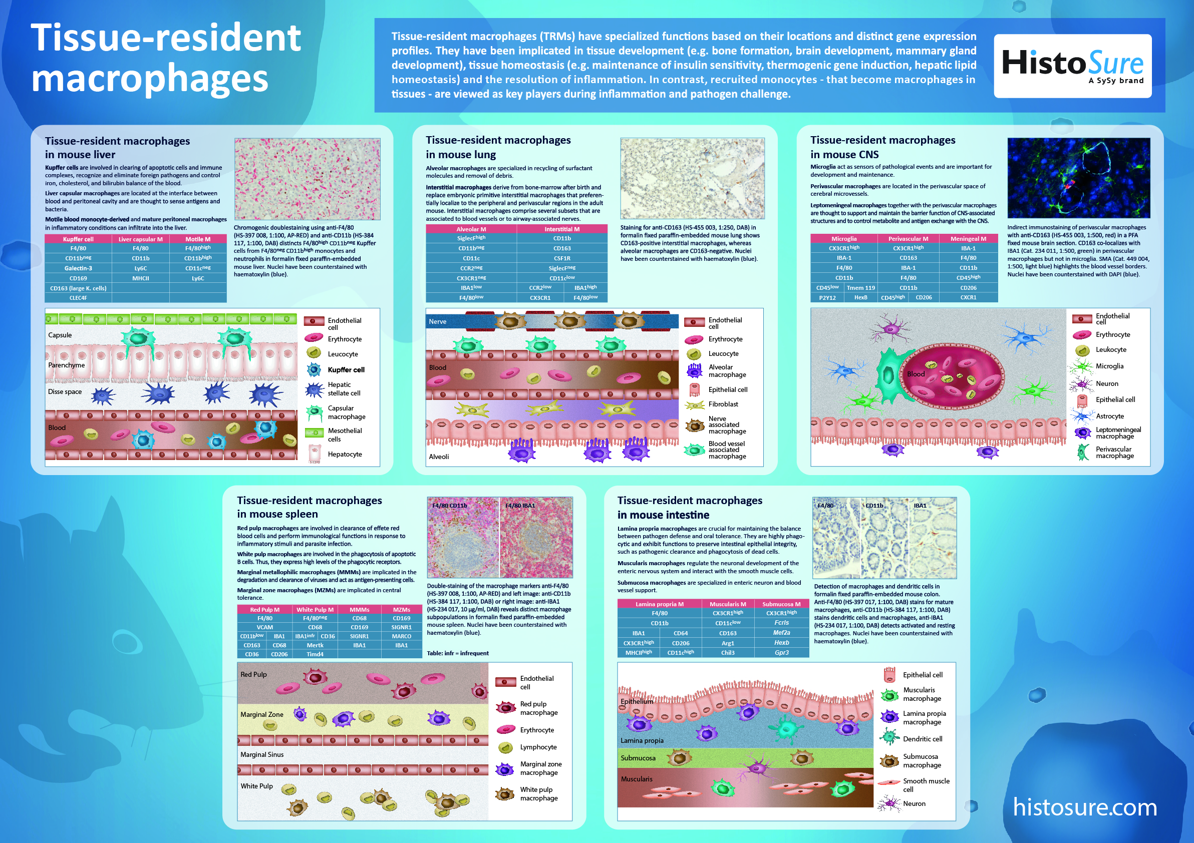 Pictures and copy about Tissue-resident macrophages (TRMs)