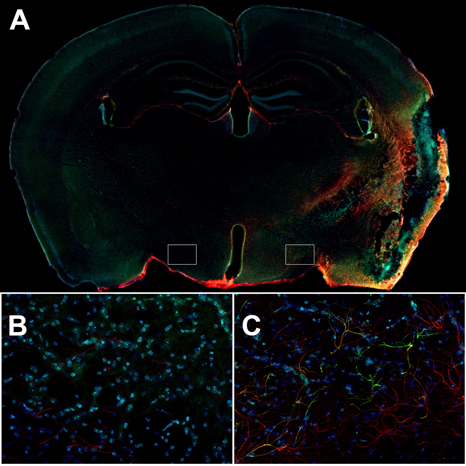 Activated astrocytes in the ipsilateral cortex of a mouse stroke brain highly express GFAP and vimentin.