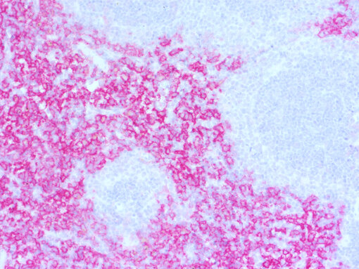 F4/80 staining using ImmPACT AP RED in mouse spleen