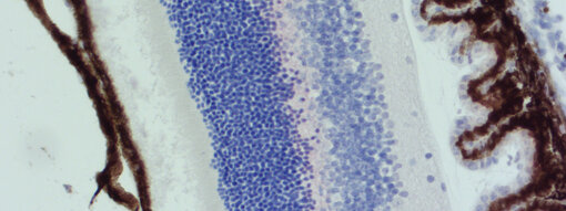 melanin in mouse retina