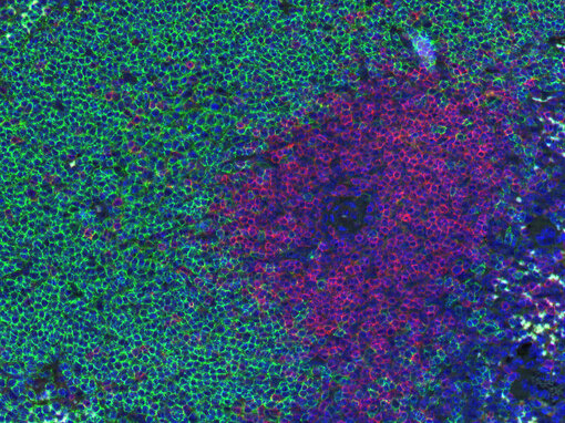 Fluorescent doublestaining of CD19 and CD3e in mouse spleen.