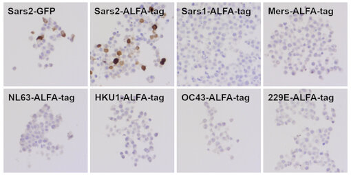 Clone #4A8 recognizes exclusively SARS-CoV-2