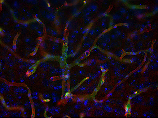 Aquaporin-4 (AQP4) is expressed on perivascular astrocytes end feet that surround blood vessels.