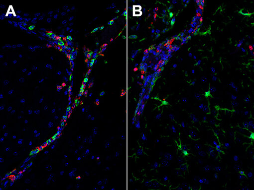Chil3 (YM-1) is a rodent-specific neutrophil granule protein that visualizes neutrophile infiltration. 