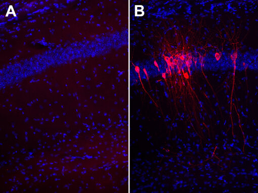 Indirect immunostaining of PFA fixed brain sections from B: a SARS-CoV-2 infected K18-hACE2 transgenic mouse in comparison to A: a non-infected control using the monoclonal anti-SARS-Cov-2 nucleocapsid antibody clone #4A8 (cat. no. HS-452 011, dilution 1:1000; red). Nuclei have been visualized by DAPI Staining (blue).